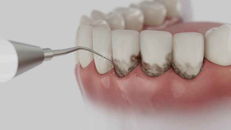 Trusted Tooth Extraction service in Folkston, GA - Dentist Open Now